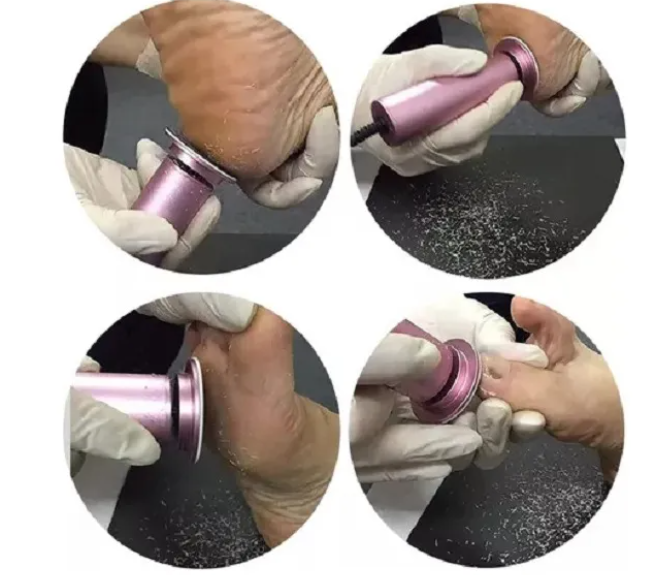 REMOVEDOR ELÈCTRICO DE CALLOS GH-99